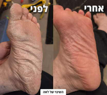 מכונת פדיקור ™VelisseTouch