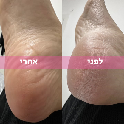 גרביי סיליקון לשמירת לחות